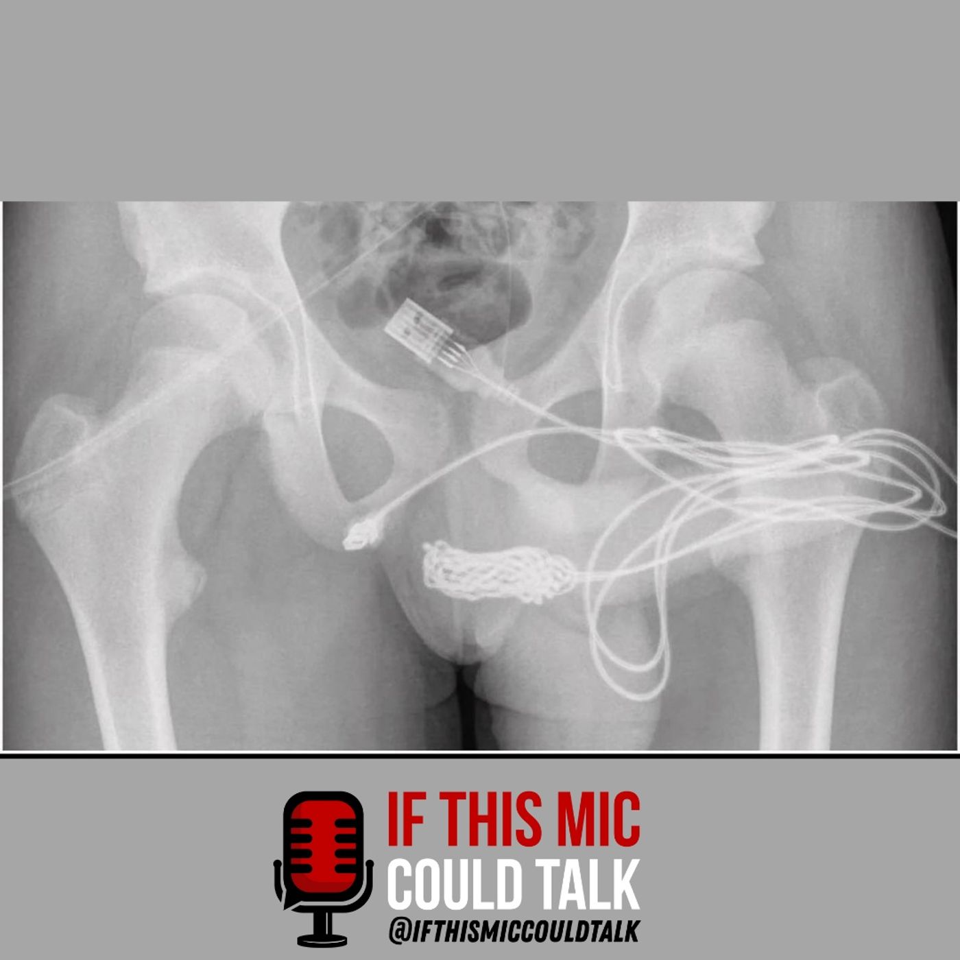 If This Mic Could Talk