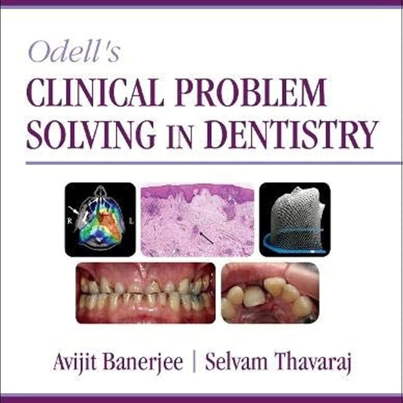Odell's Clinical Problem Solving in Dentistry episode artwork