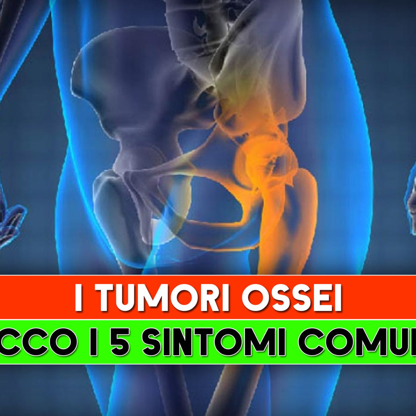 I Tumori Ossei: Ecco I 5 Sintomi Comuni! episode artwork