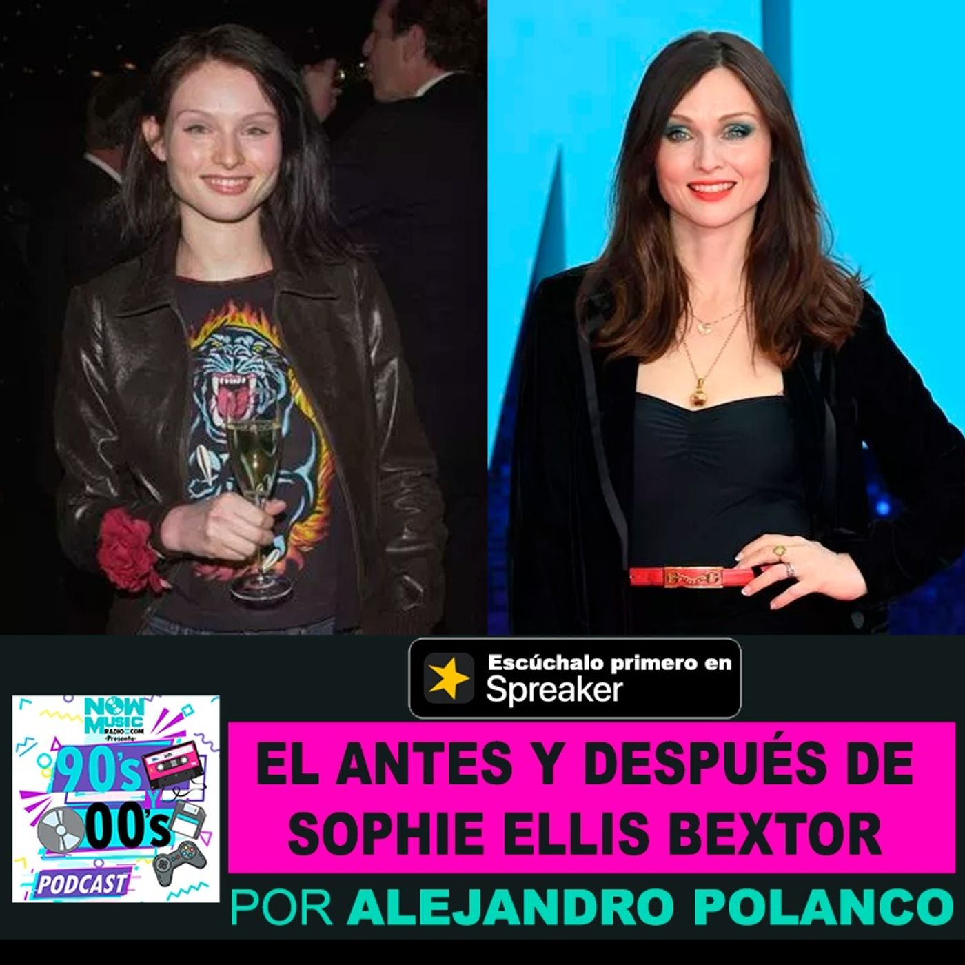 El Antes y Después de Sophie Ellis Bextor episode artwork