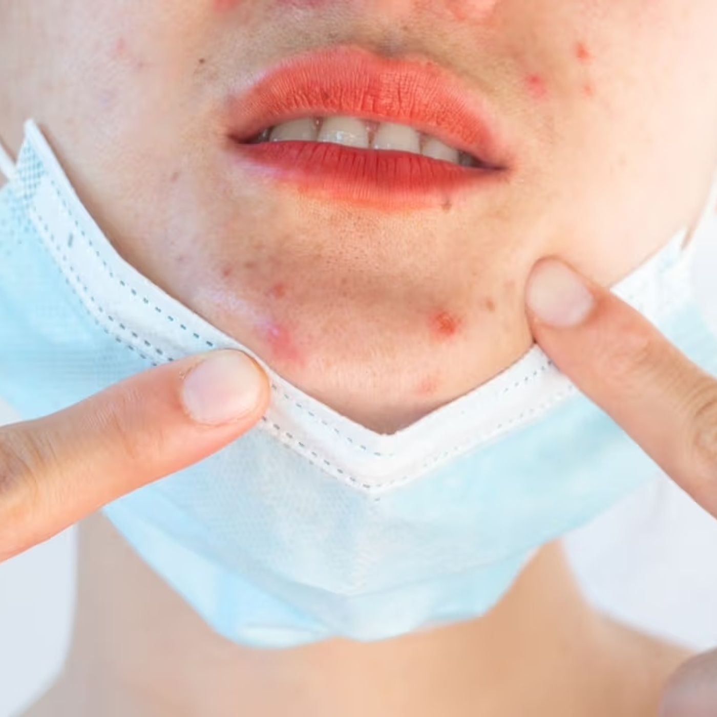 Hevoluta. Semina la Bellezza, Raccogli la Salute