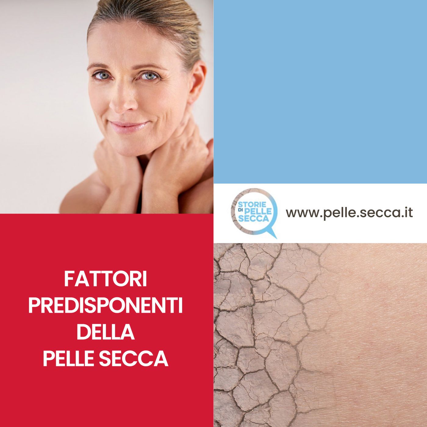 Storie di Pelle Secca