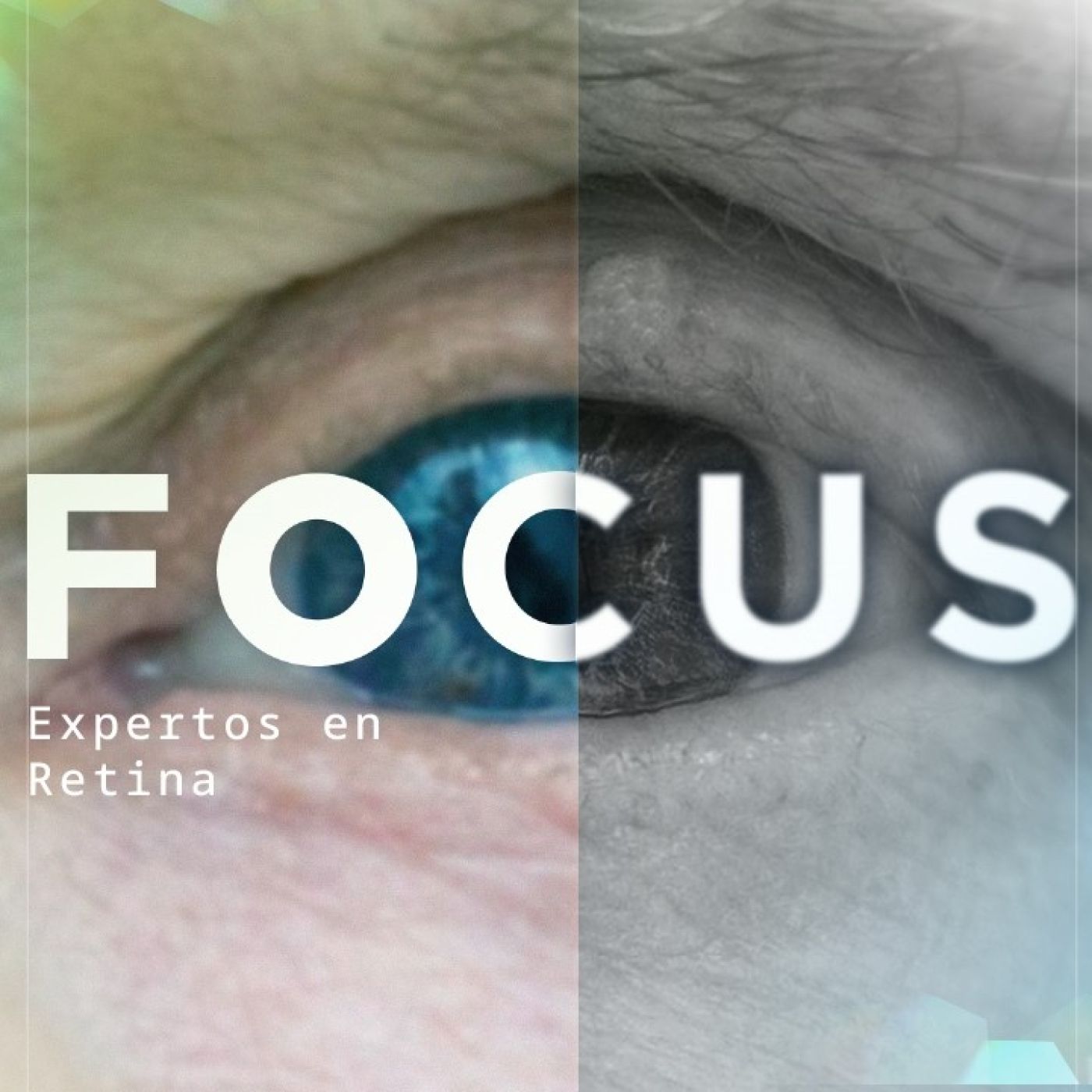 Focus, expertos en retina, by Bayer