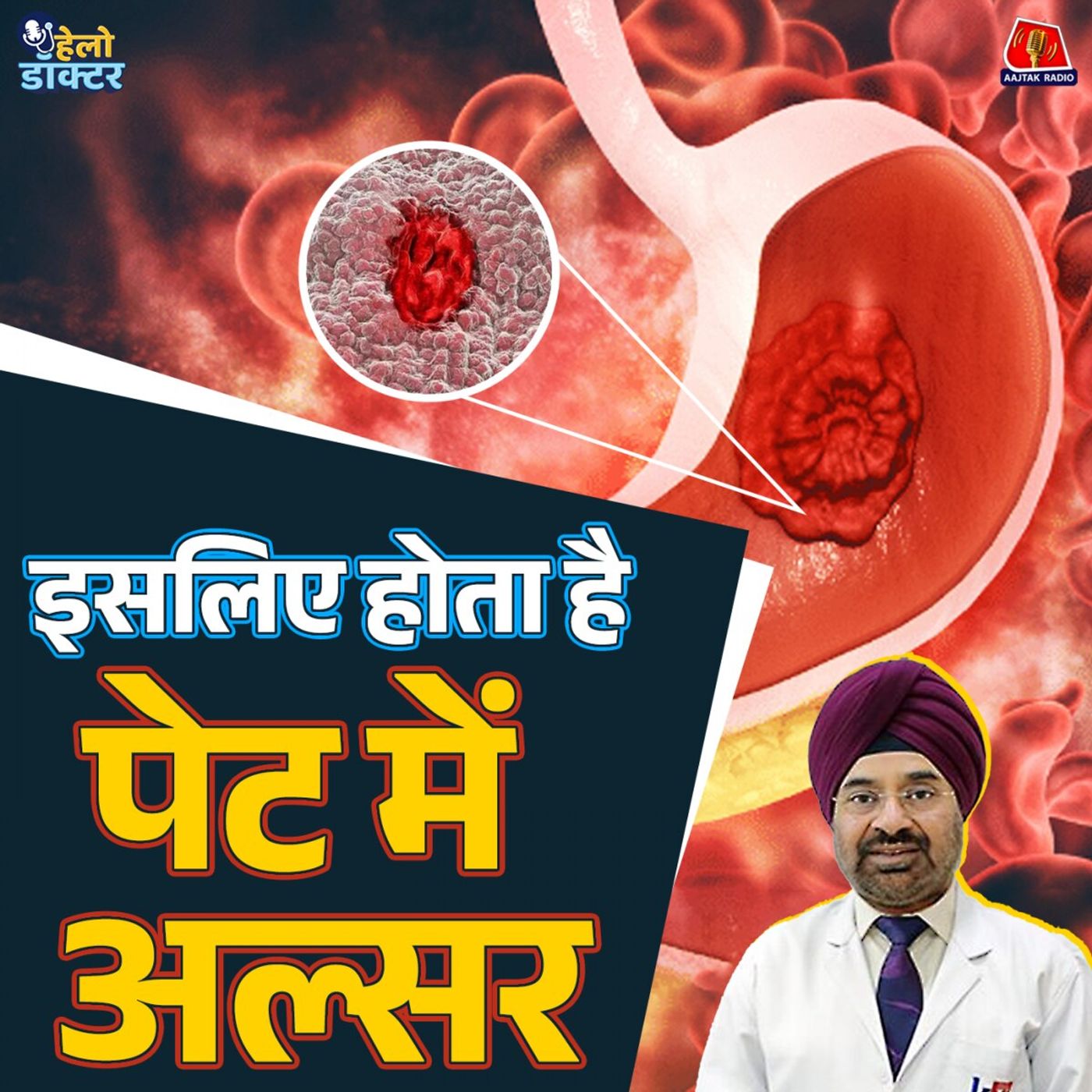 देसी इलाज करते-करते पेट में छेद न हो जाए! जानिए पेट के अल्सर के लक्षण और इलाज : हेलो डॉक्टर