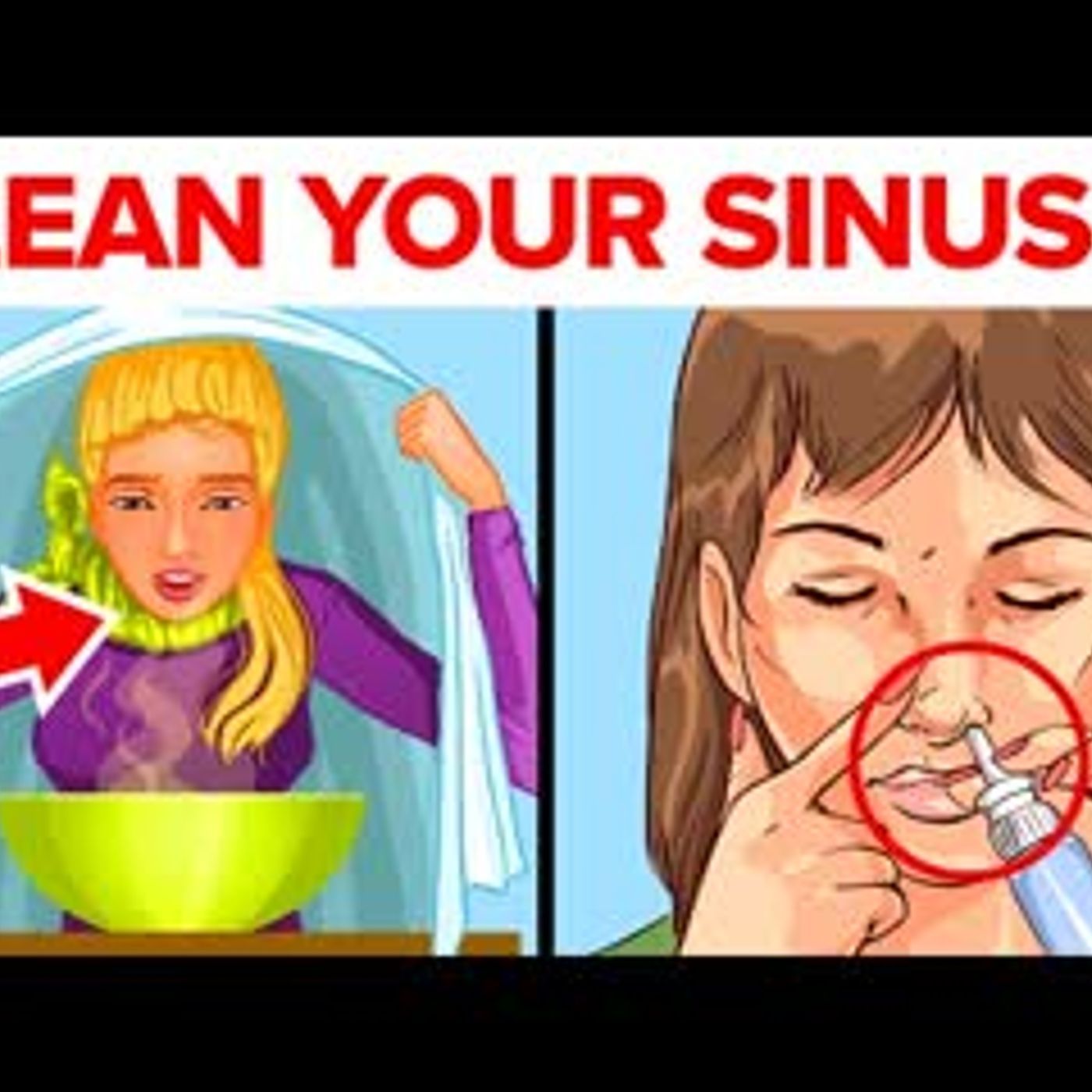 14 Natural Remedies To Clear Out Your Sinuses episode artwork