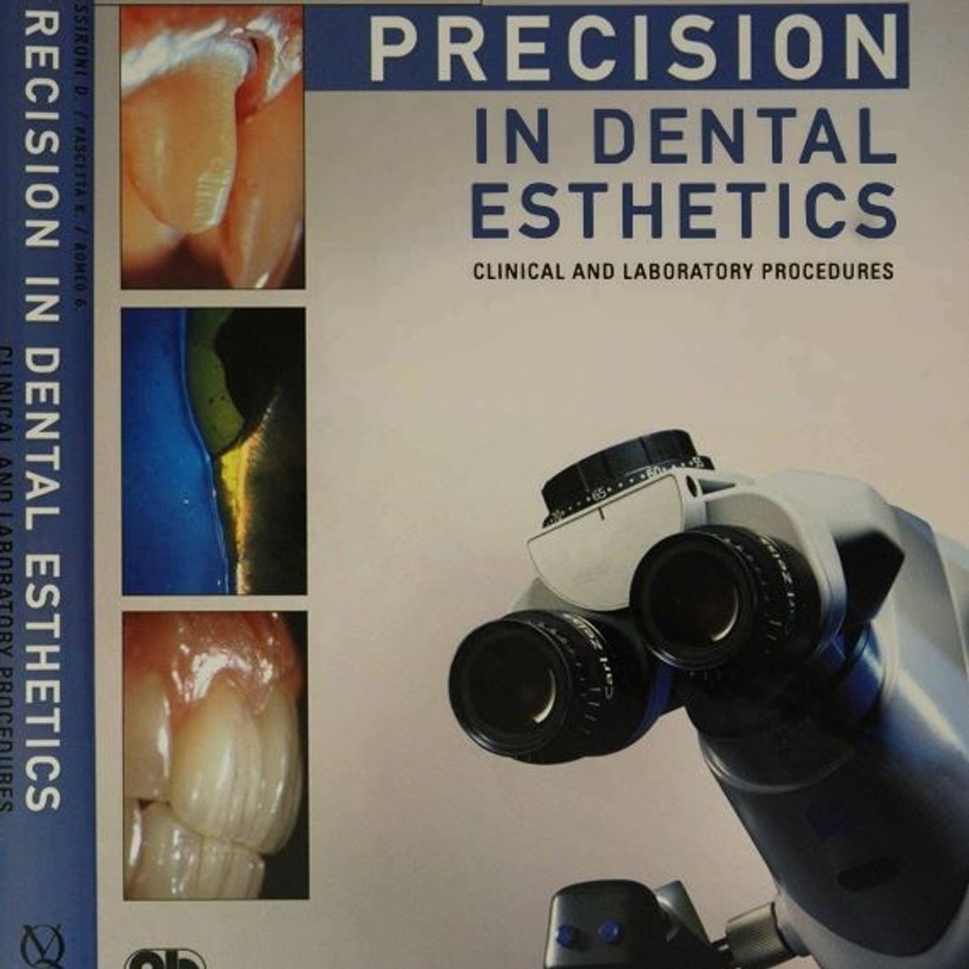 Precision in Dental Esthetics