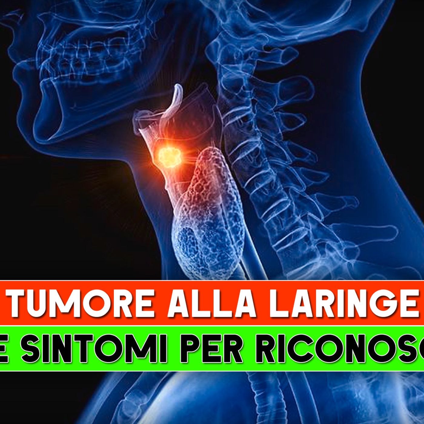 Tumore Alla laringe: I Sette Sintomi Per Riconoscerlo! episode artwork