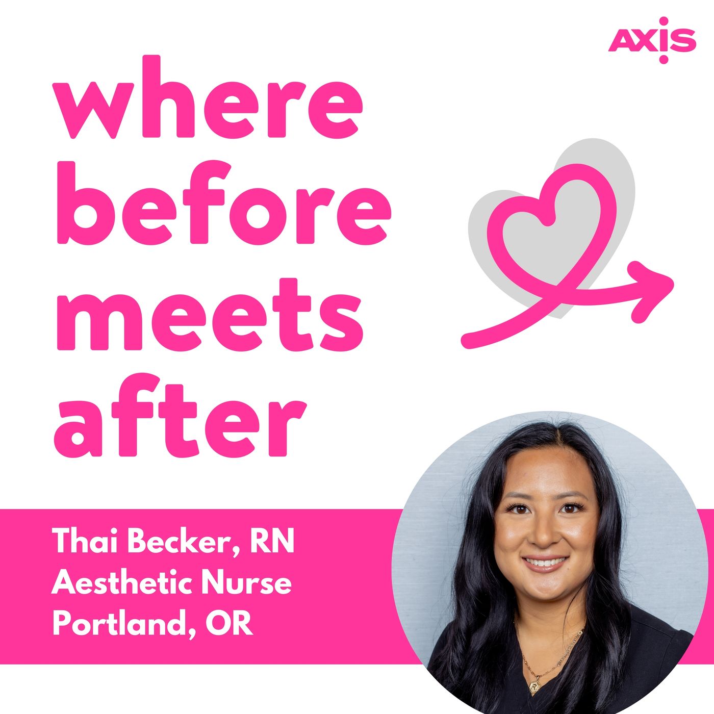 What SkinPen microneedling does to your skin [Thai Becker, RN, Portland]