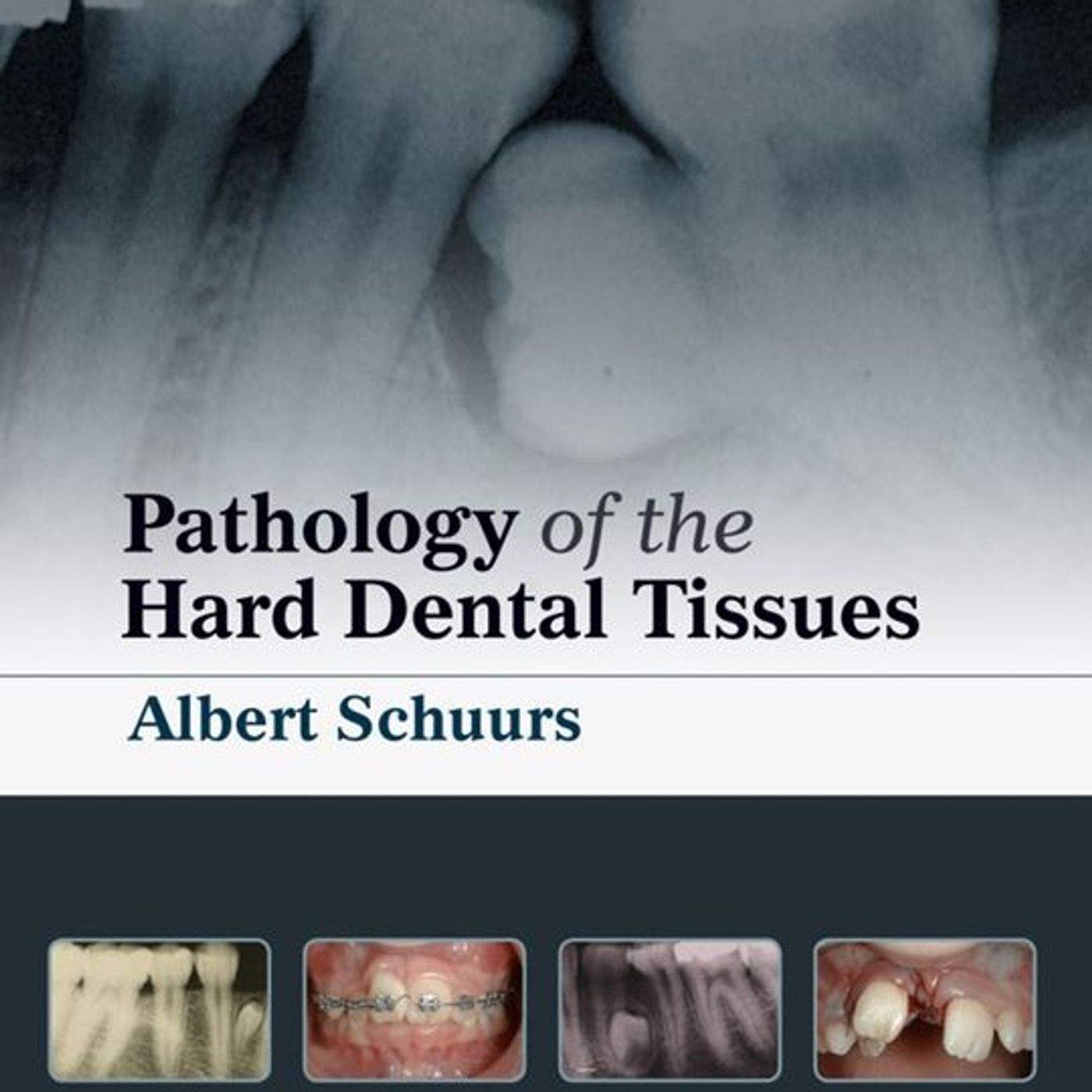 Pathology of the Hard Dental Tissues