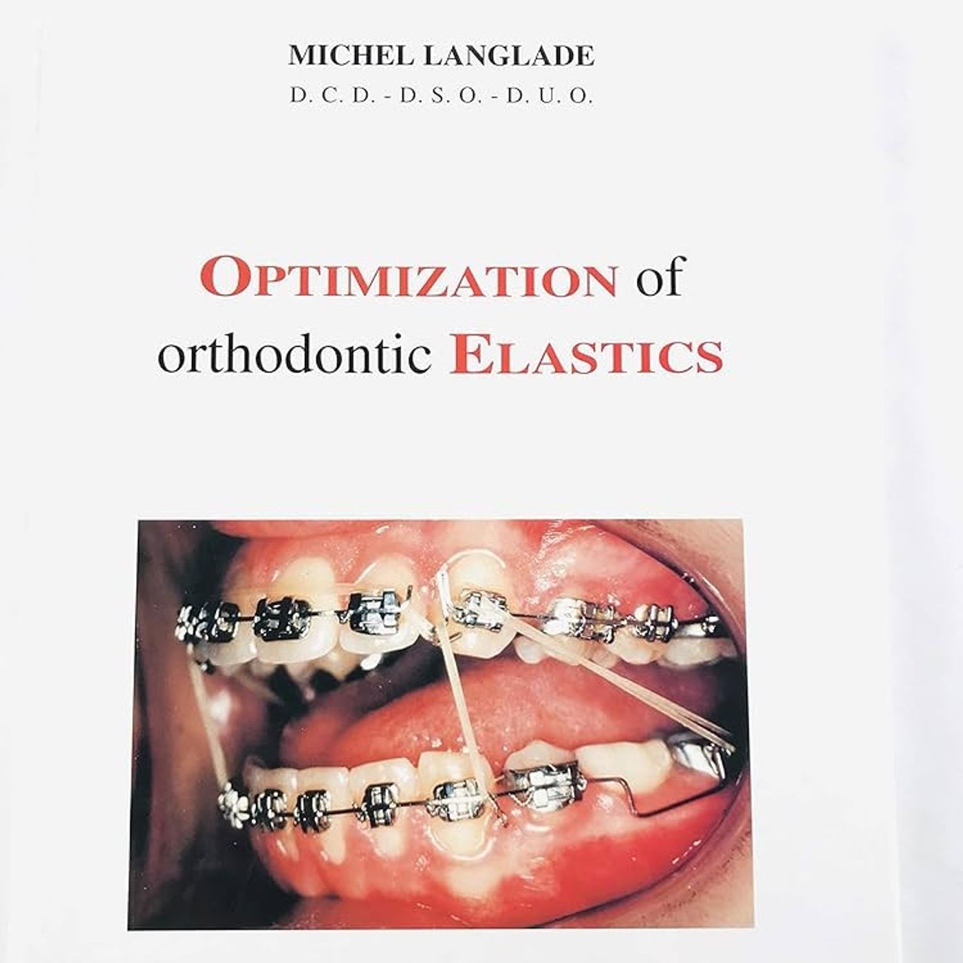 Optimization of orthodontic elastics