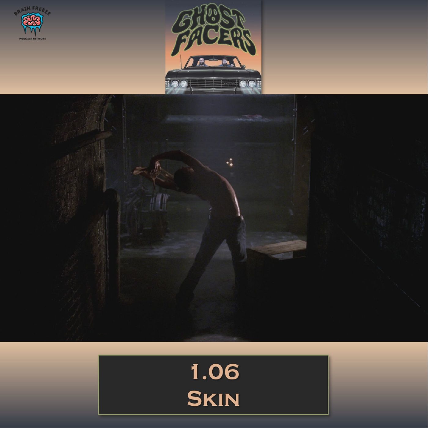 1.06: Skin