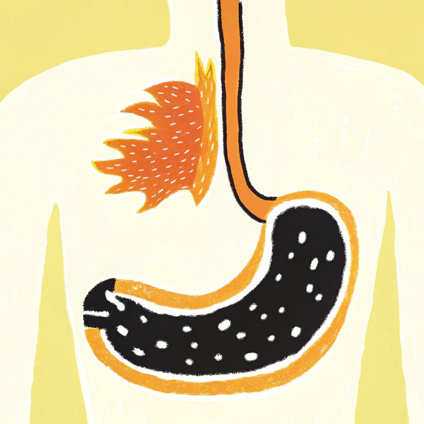 The Hidden Truth About Acid Reflux: Why More Acid is the Cure