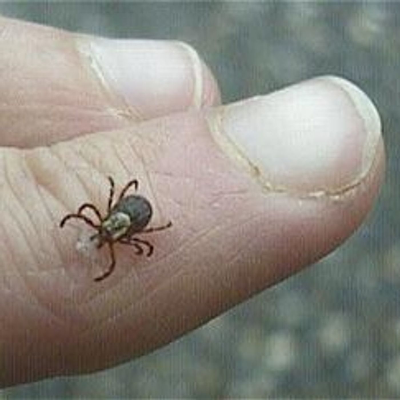 Bob Oley, tick-borne disease episode artwork