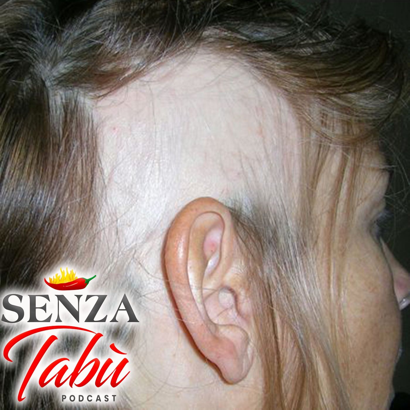 ALOPECIA ⚠️ QUANDO TI MANCANO I CAPELLI 🌶