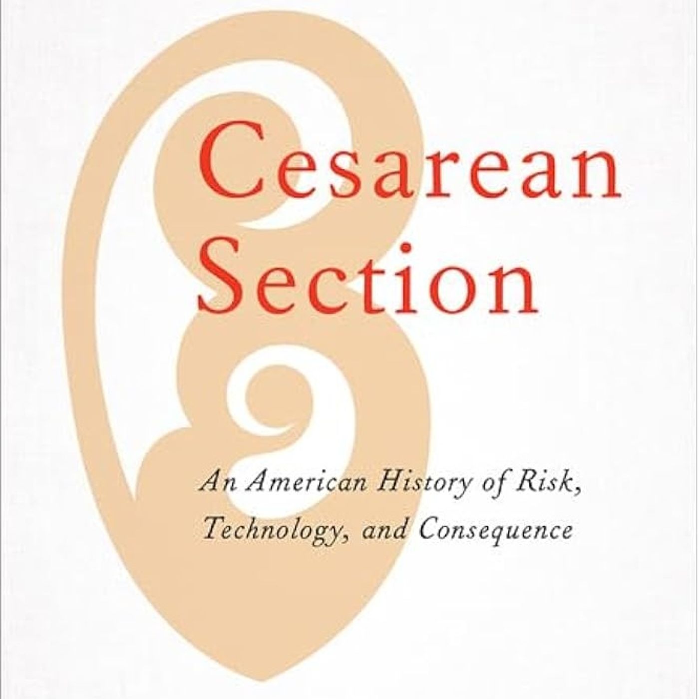 Cesarean Section: An American History of Risk, Technology, and Consequence