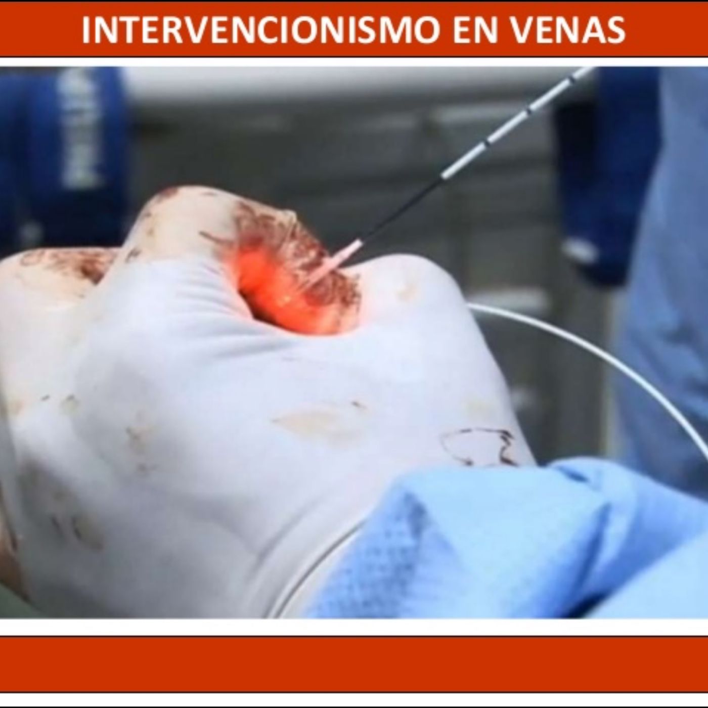 Episodio 2 Se Heredan Los Infartos .
