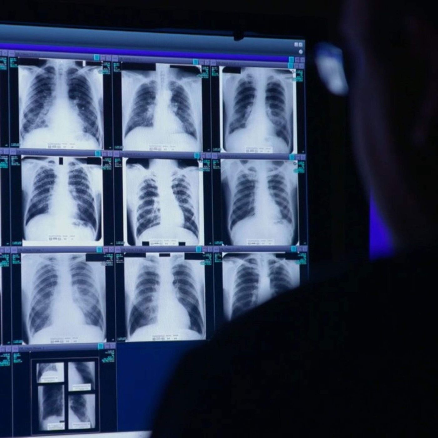 The black lung crisis deepens in Appalachia episode artwork