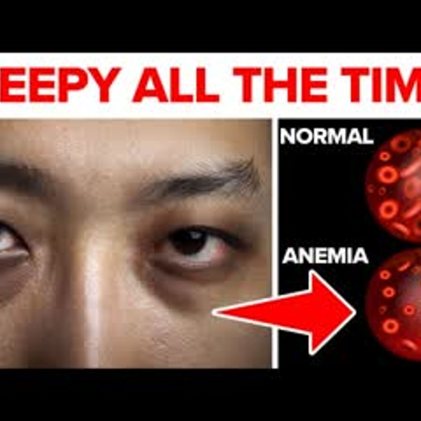 13 ALARMING Reasons Why You’re Feeling Sleepy ALL THE TIME! episode artwork