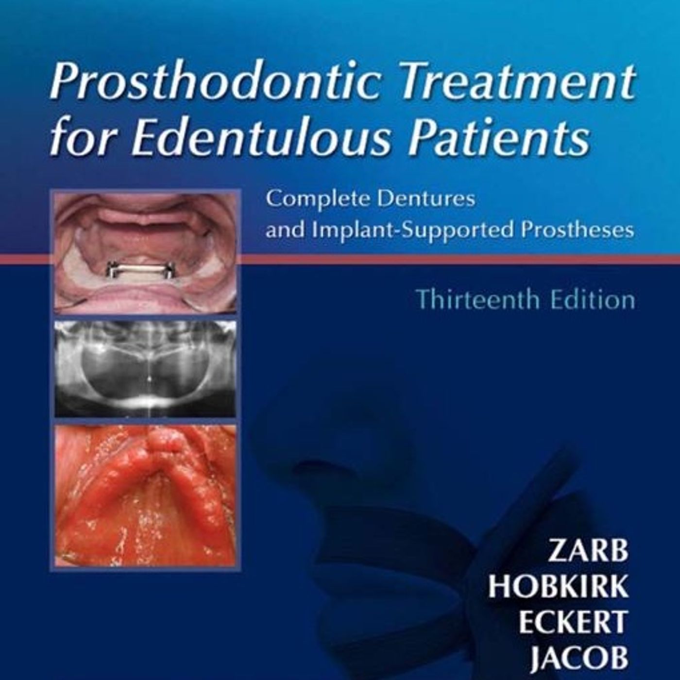 Prosthodontic Treatment for Edentulous Patients