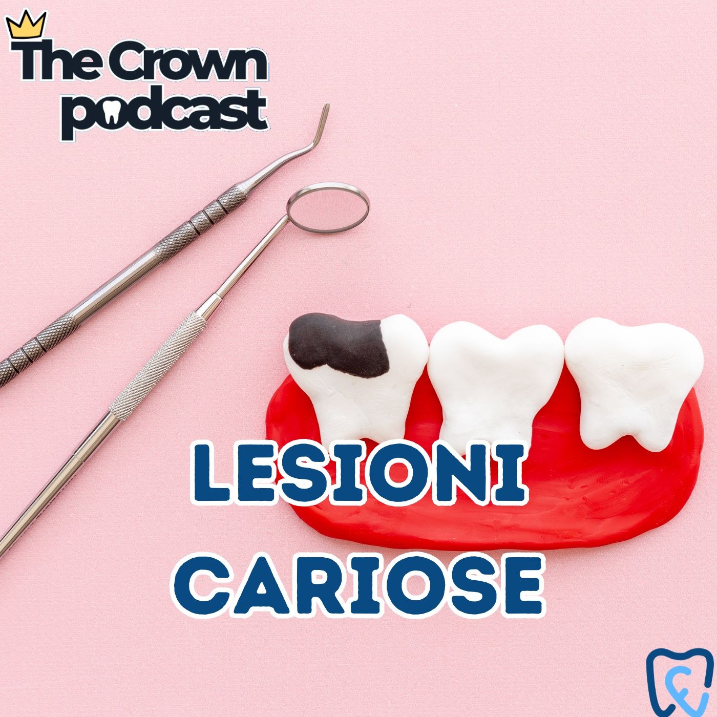 The Crown - Un podcast dentale