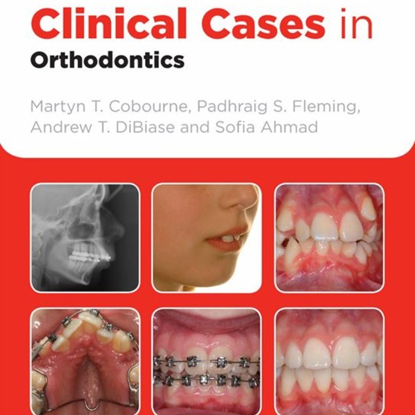 Clinical Cases in Orthodontics