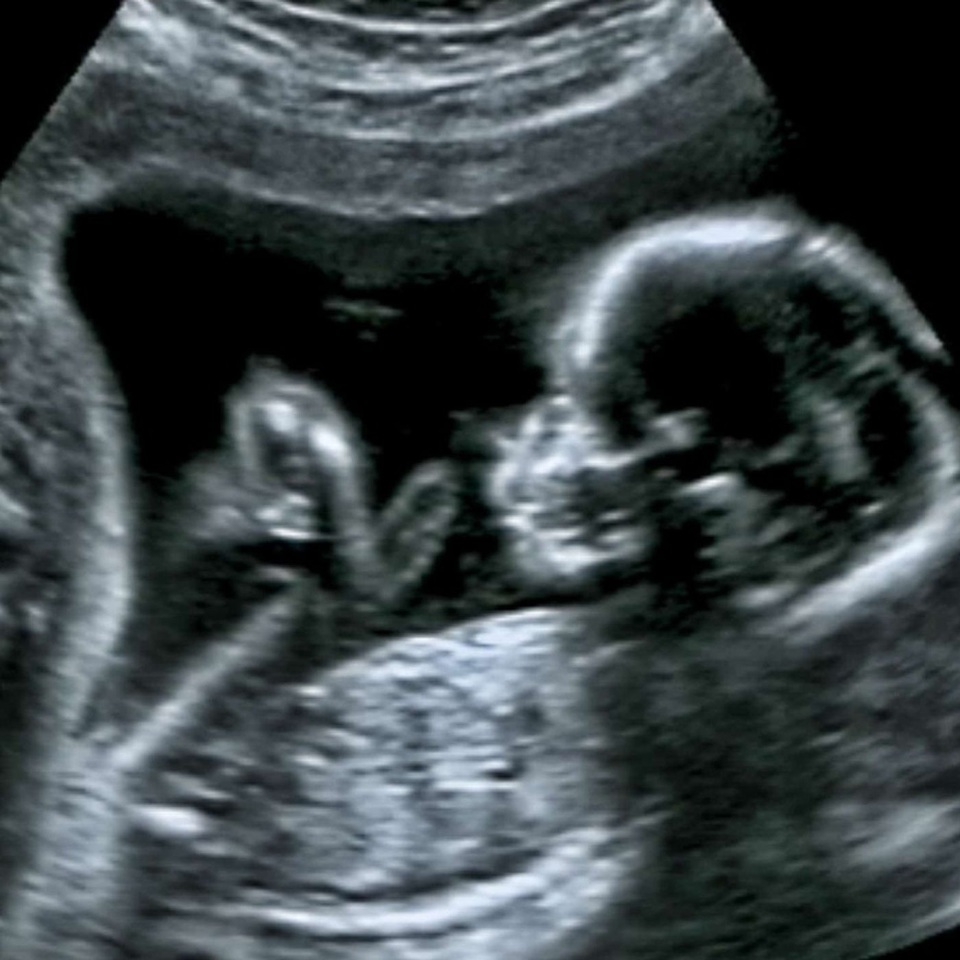 January 22: Day of Prayer for the Legal Protection of Unborn Children (U.S.A.)