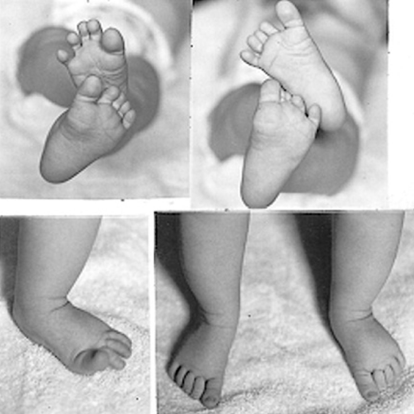 "Webbed Feet" by Doctor's Orders?!!!