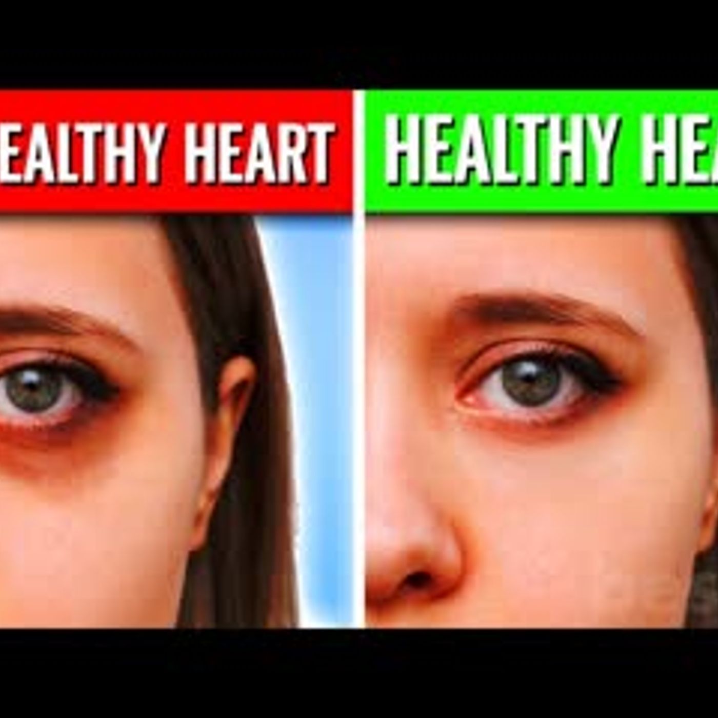 11 Lifestyle Habits To Keep Your Heart Young & Healthy Forever episode artwork