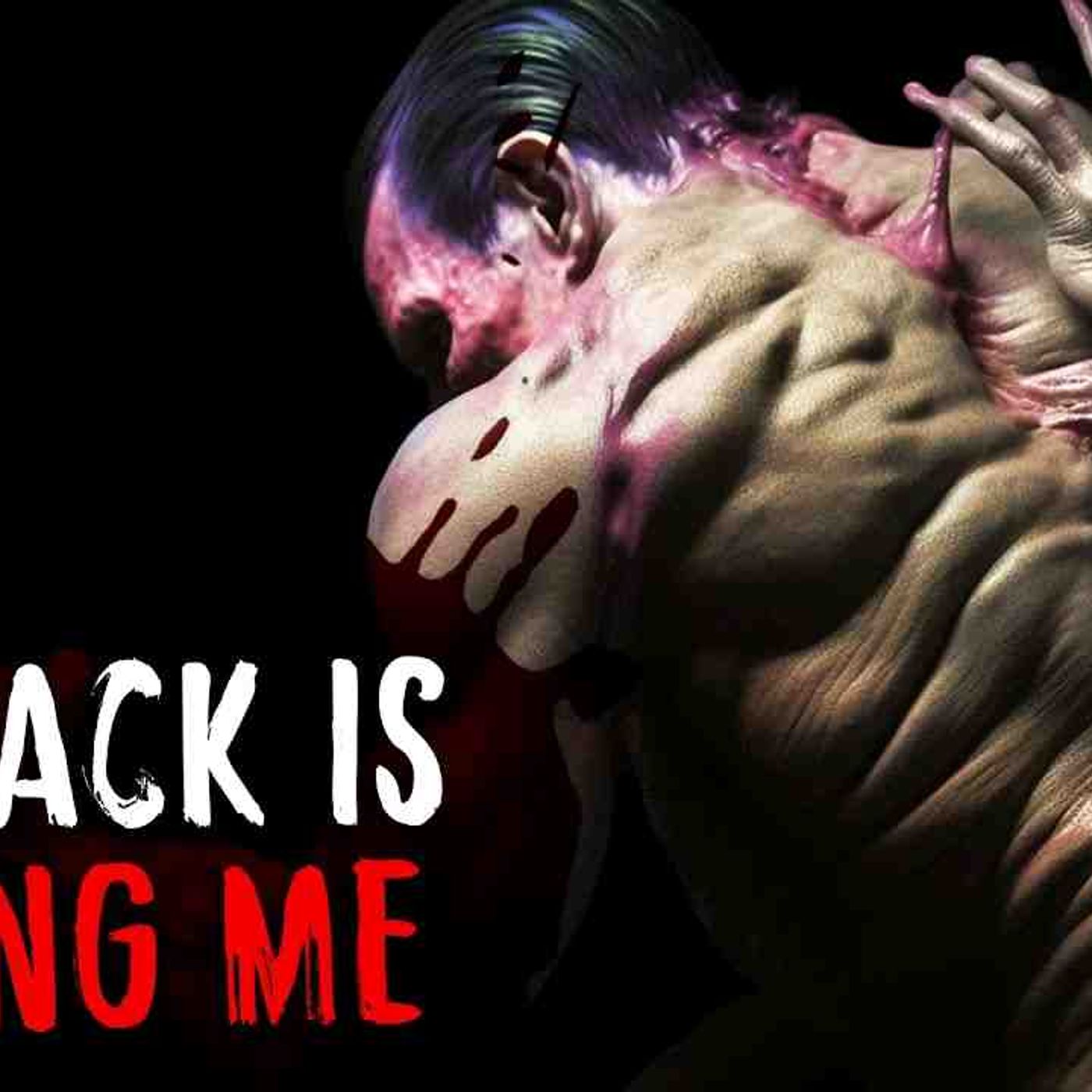 My Back is Killing Me