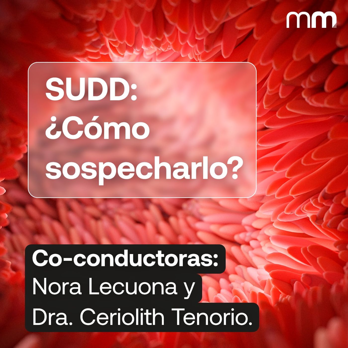 ¿Dolor abdominal crónico y estudios normales? Podría ser SUDD.