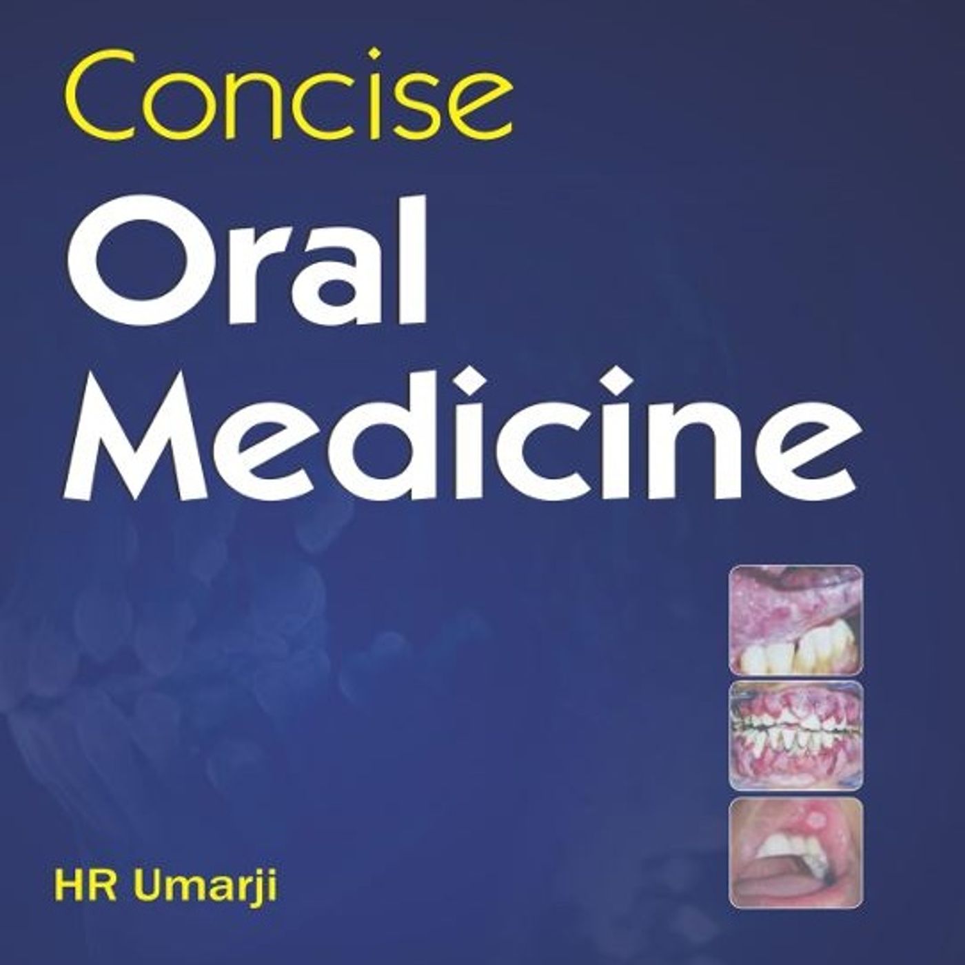 Concise Oral Medicine