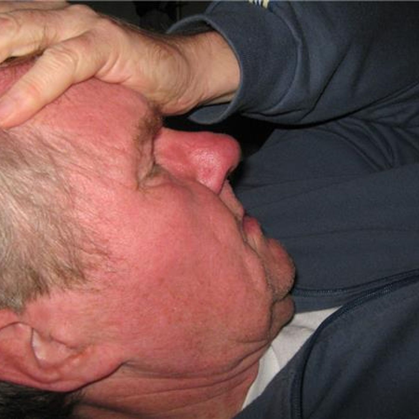 Survival Medicine Hour: Headaches, Fractures, More