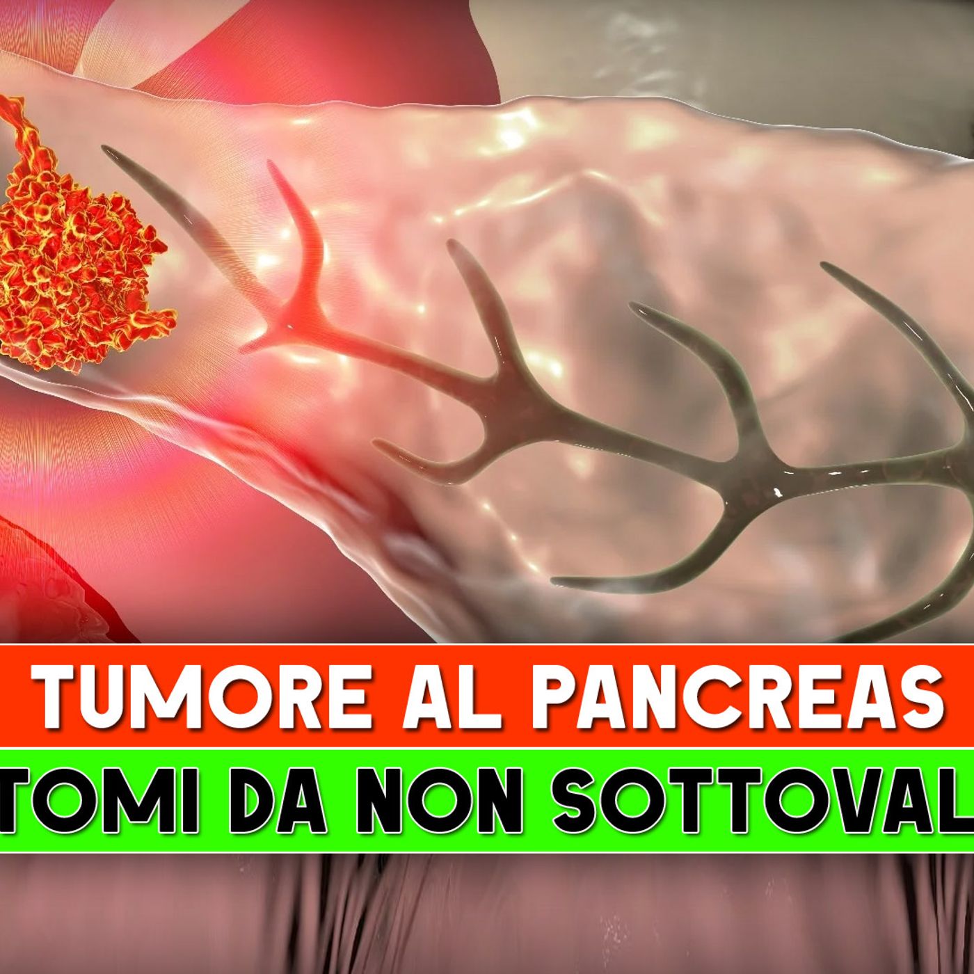 Tumore Al Pancreas: I 5 Sintomi Da Non Sottovalutare! episode artwork