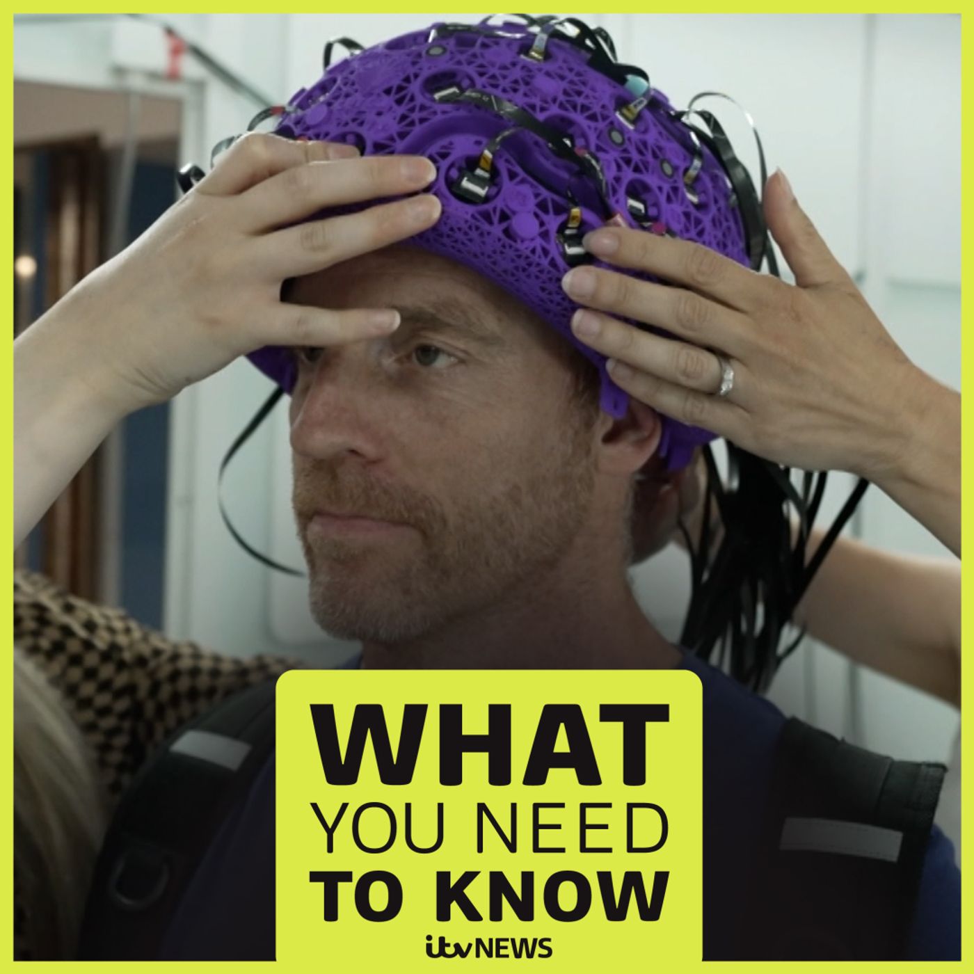What You Need To Know