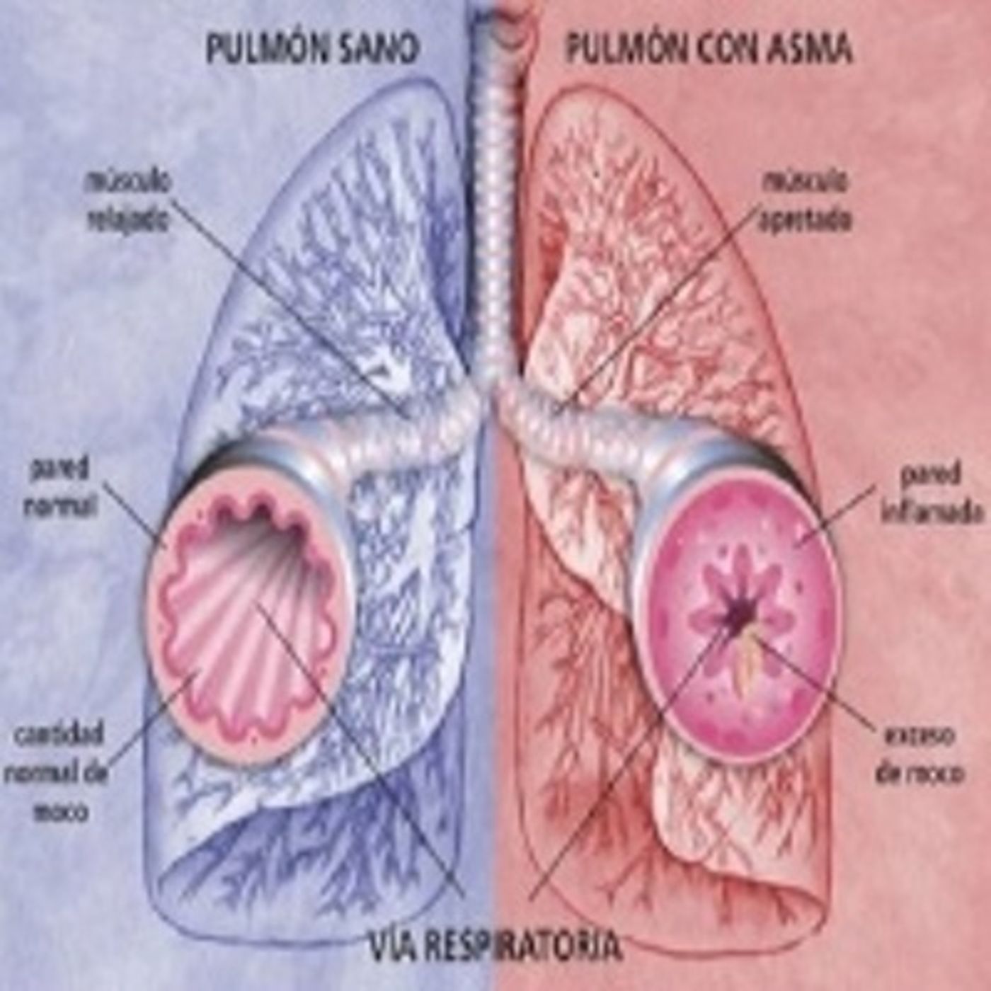 Asma controlada y Signos de alarma episode artwork
