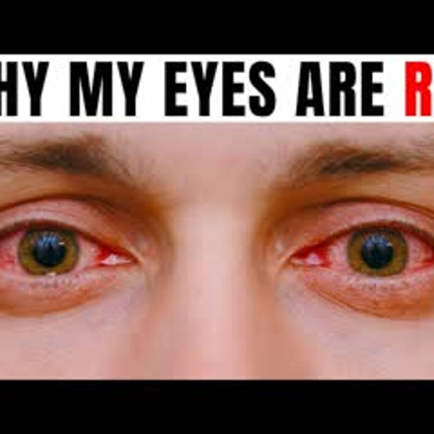 13 Reasons Why Your Eyes Are Always Red episode artwork