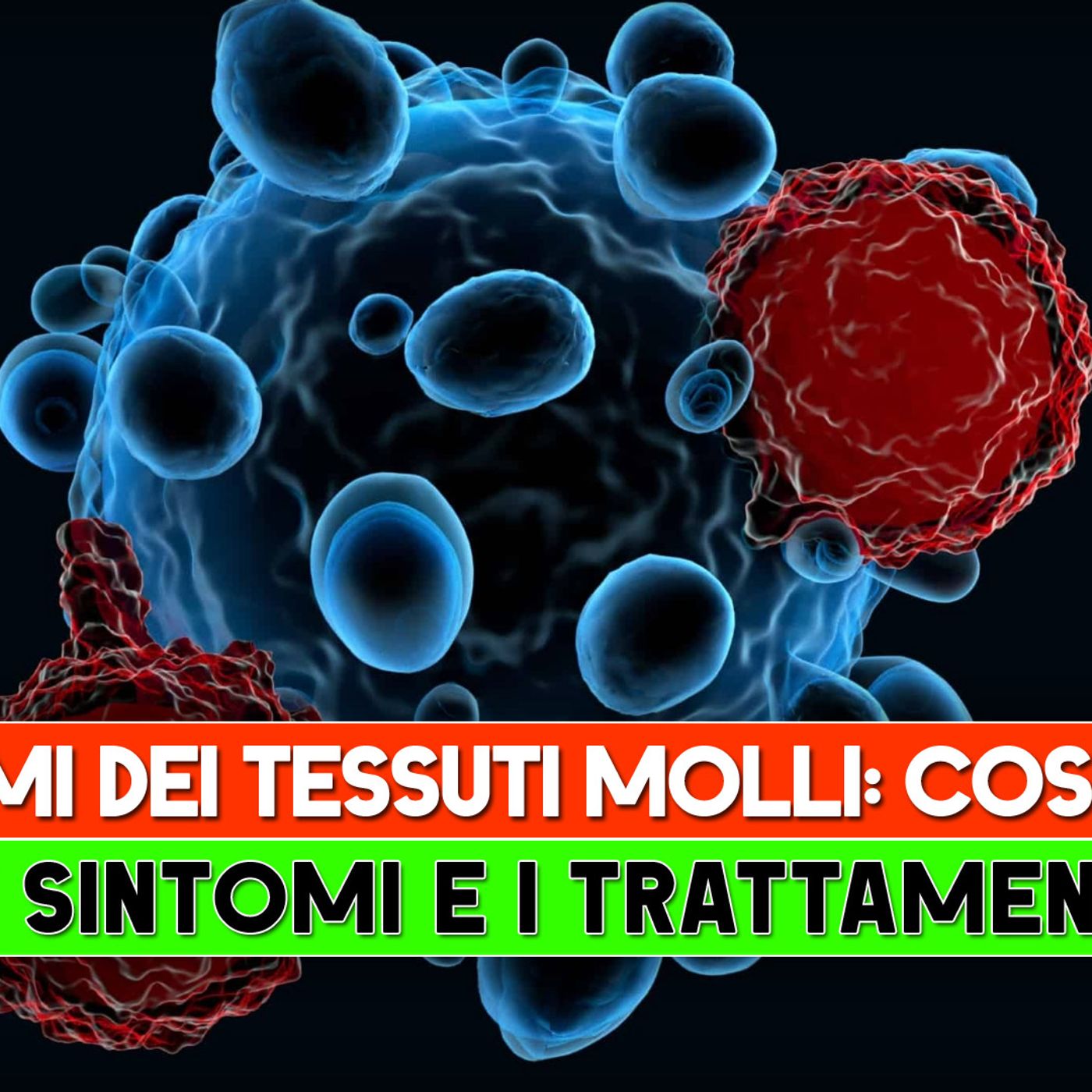 Sarcomi dei Tessuti Molli: Cosa Sono, I 7 Sintomi e Trattamenti! episode artwork