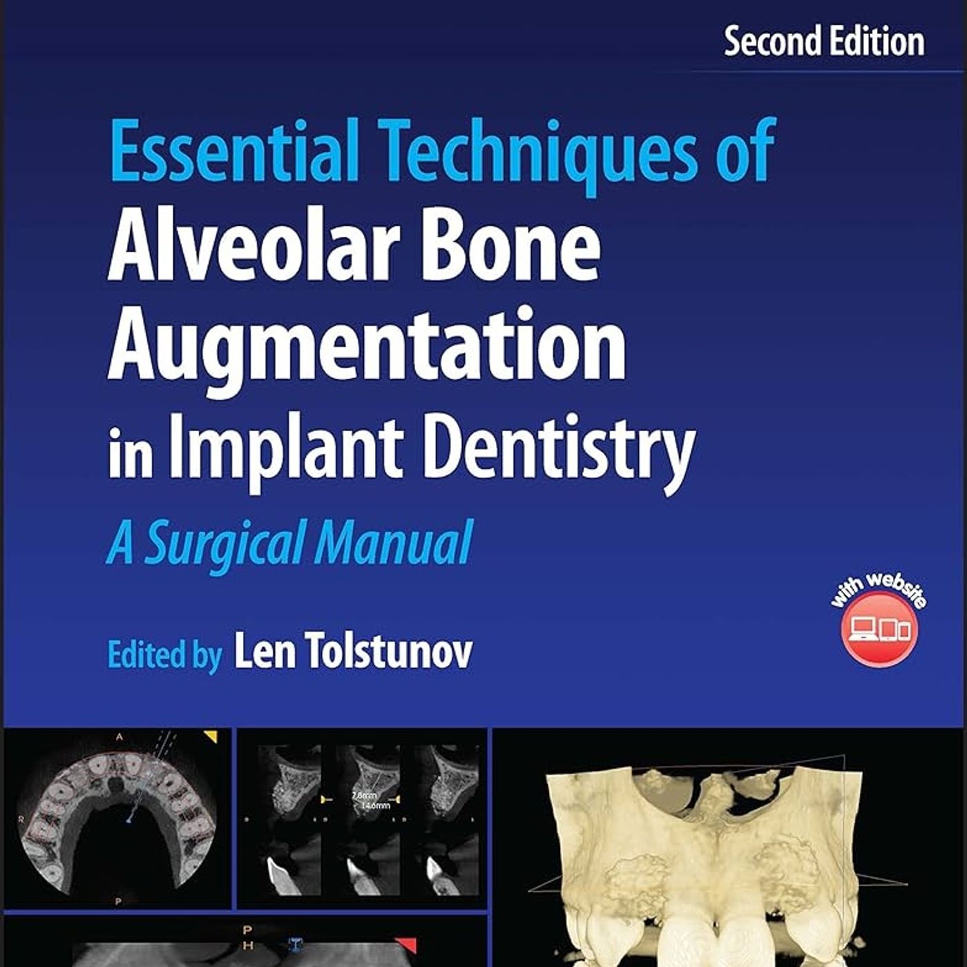 Essential Techniques of Alveolar Bone Augmentation in Implant Dentistry: A Surgical Manual