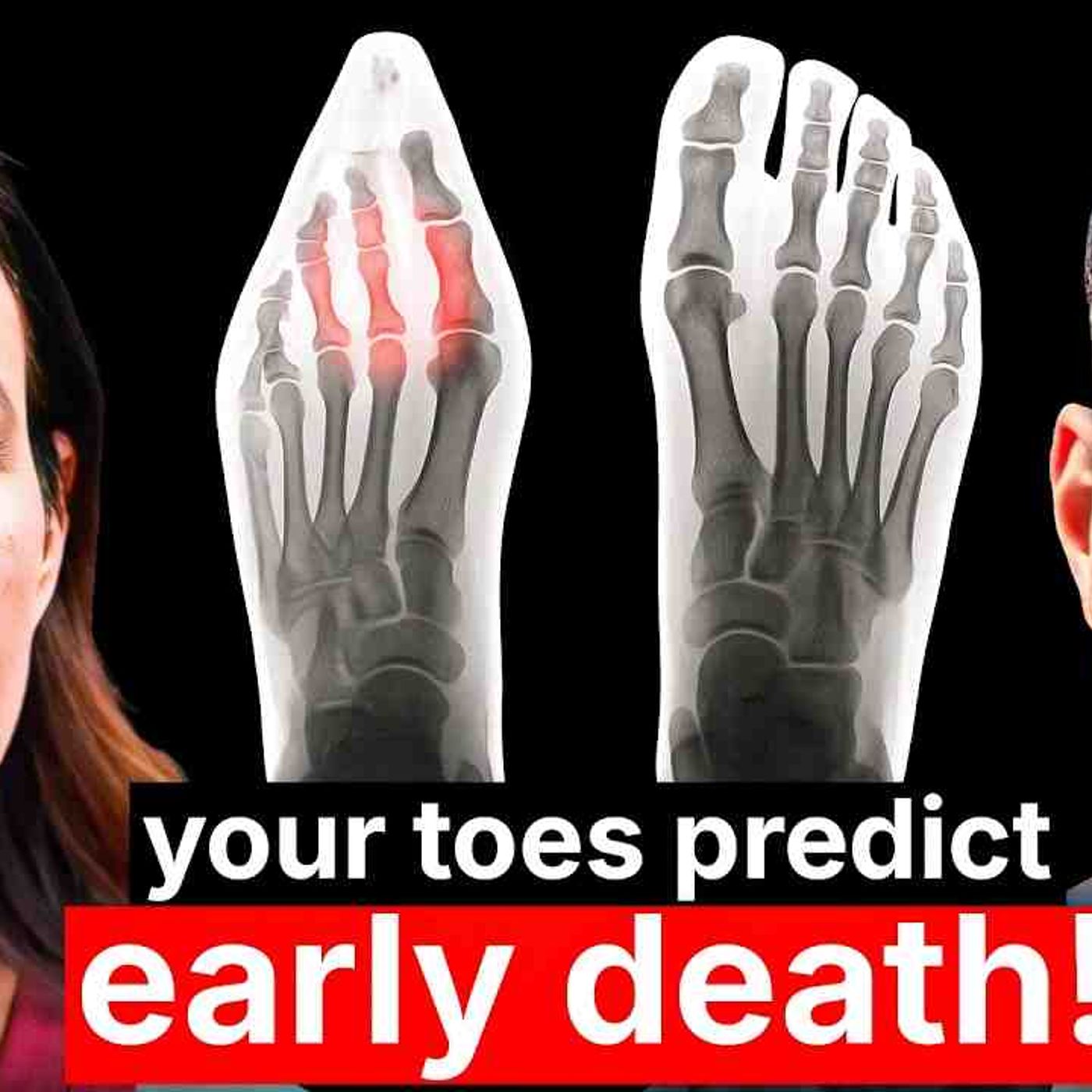 The Foot Expert_ Your Toes Can Predict If You_ll Die Early_ This Will Fix Plantar Fasciitis episode artwork