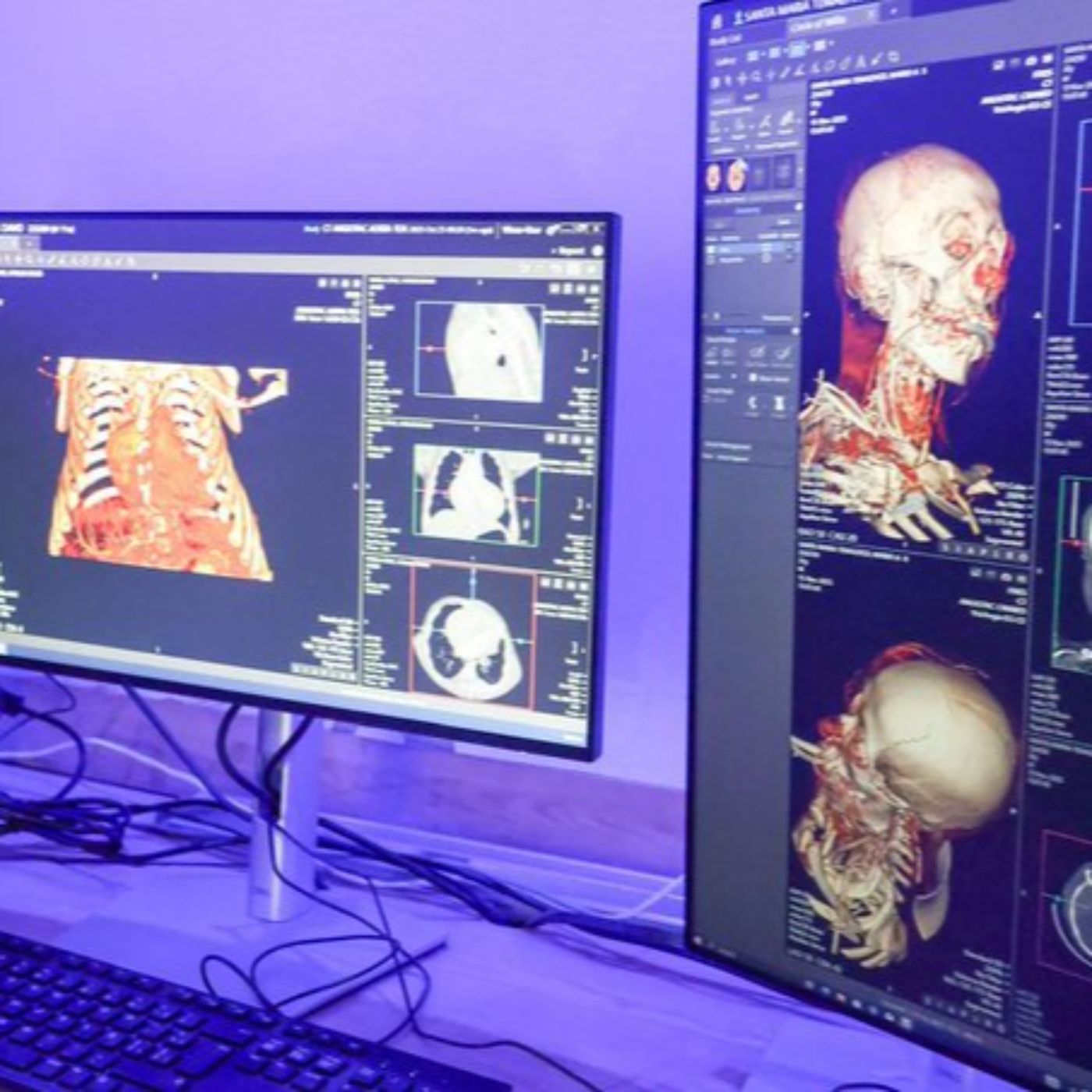 MODERNIZA EL GOBIERNO DE TLAXCALA EL ITAES CON 125 MDP, PERO PERSISTEN DUDAS SOBRE SU ALCANCE REAL