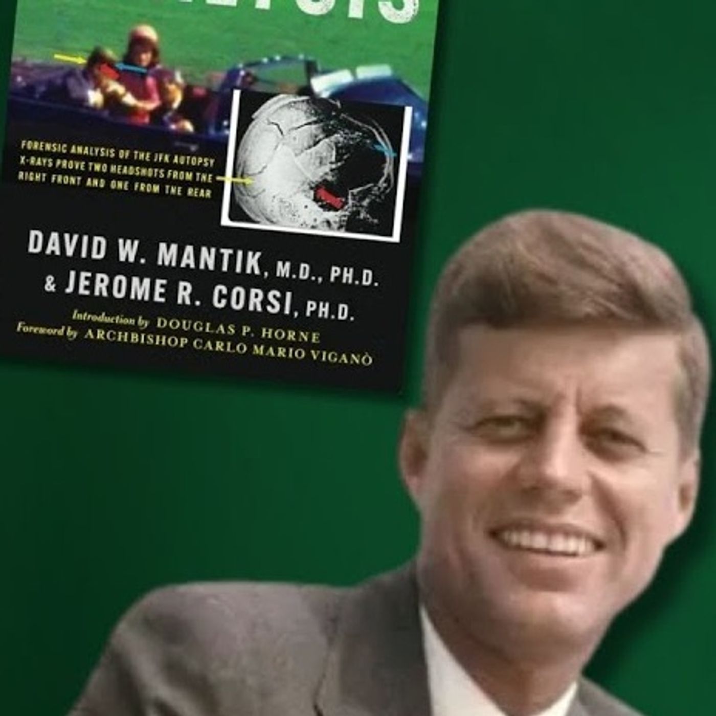 The Truth About the #JFK Assassination The Medical Cover Up