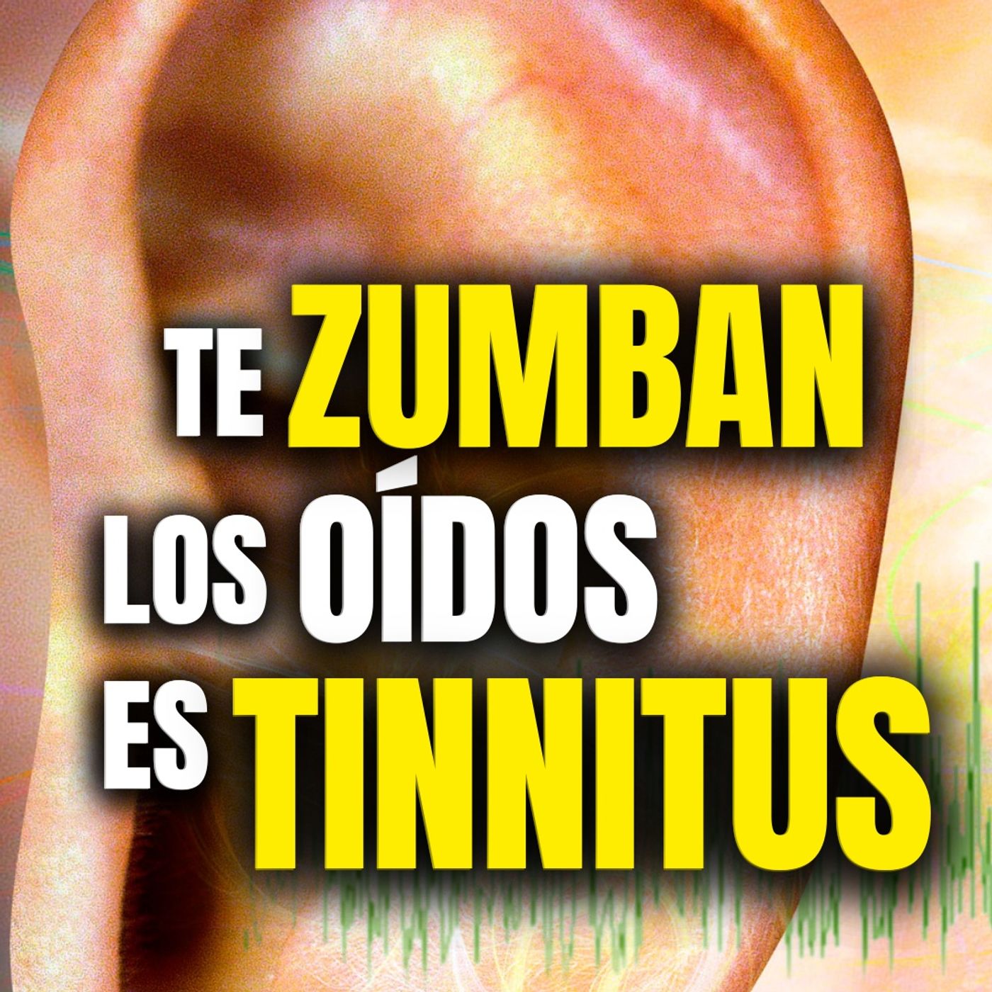 El tinnitus es como oír tus propios pensamientos.