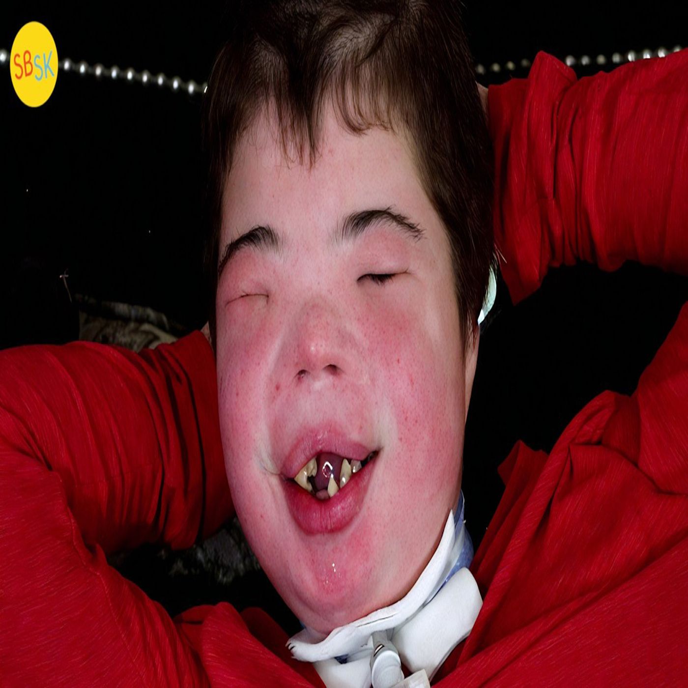 Living with One of the Rarest Conditions Ever (Brody's Battle) episode artwork