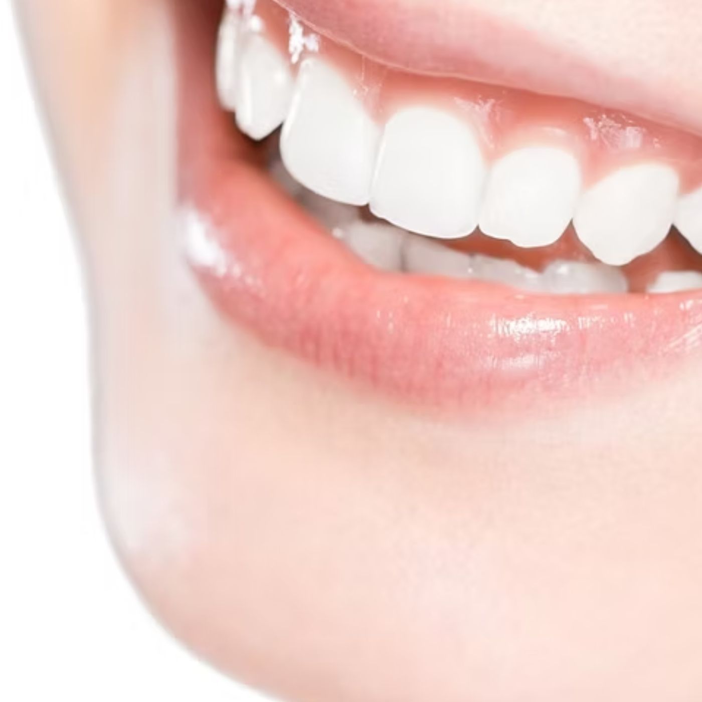 In-Chair Whitening Near South Brisbane