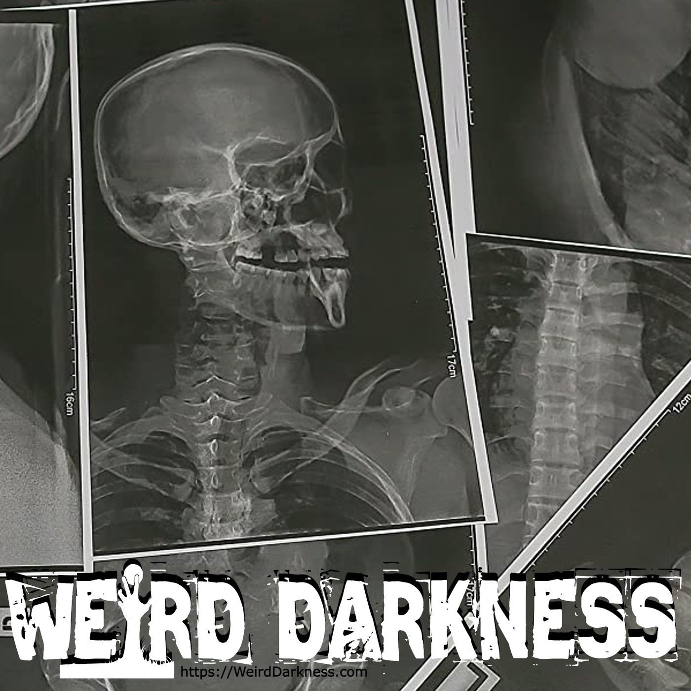 cover of episode “FREAKY AND CREEPY MEDICAL CASES” #WeirdDarkness