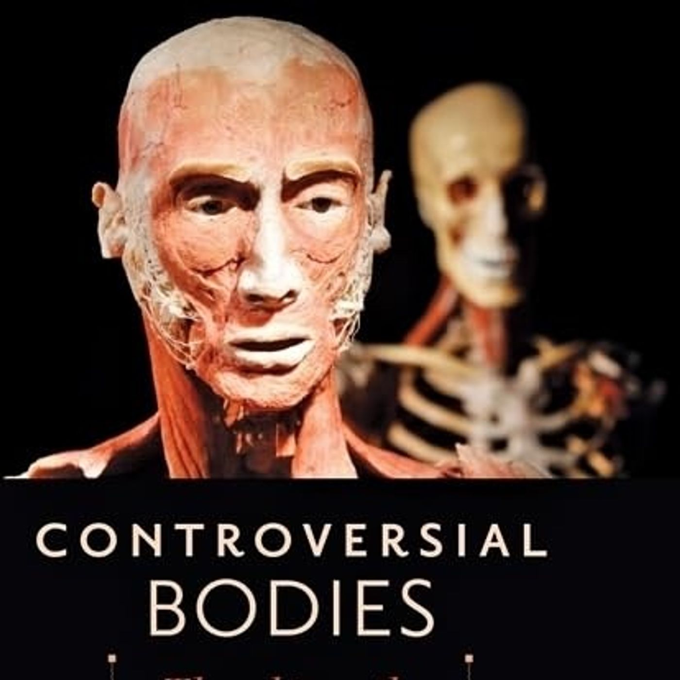 Controversial Bodies: Thoughts on the Public Display of Plastinated Corpses