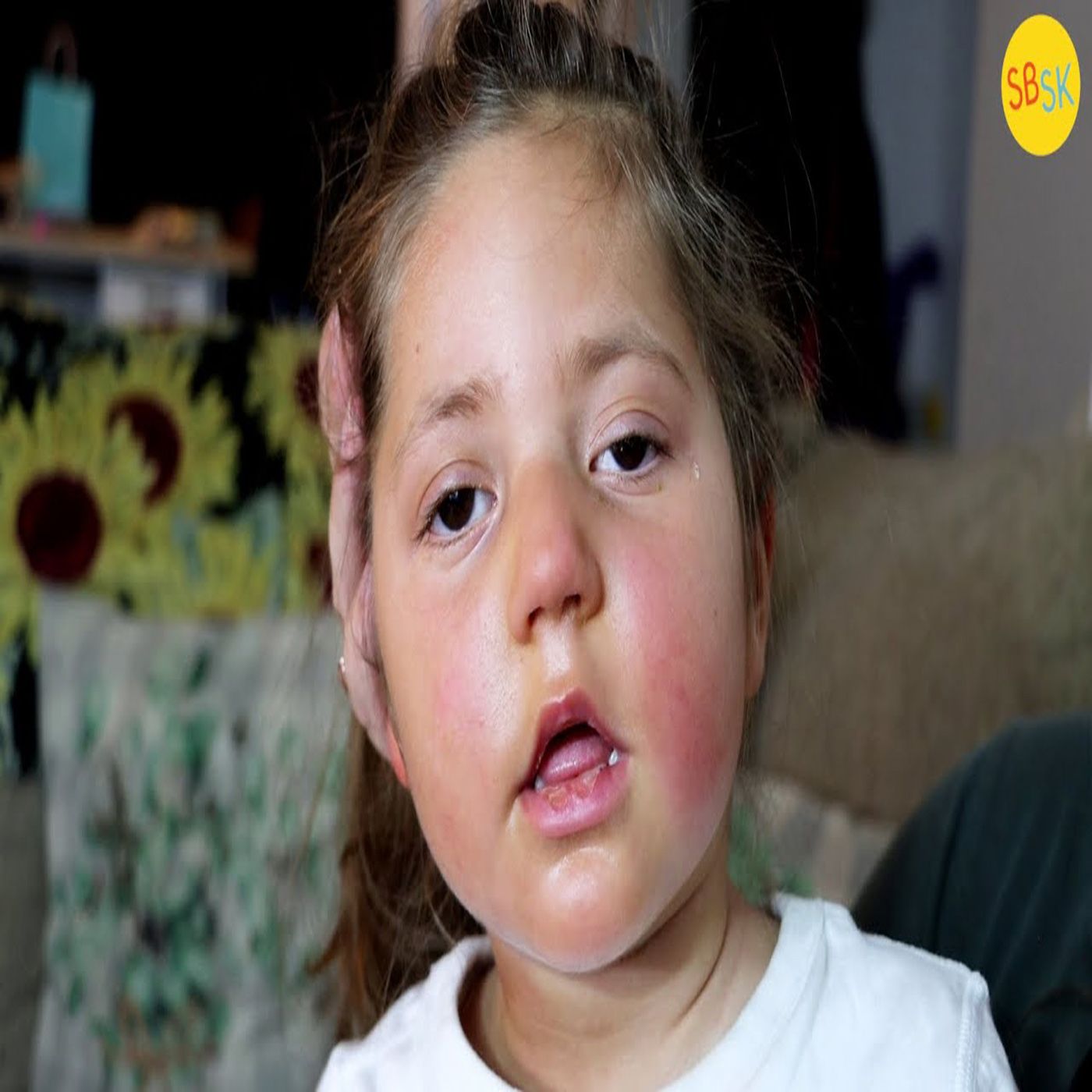 A Toddler with a Severe Brain Injury (And Her Loving Family) A Toddler with a Severe Brain Injury (And Her Loving Family)