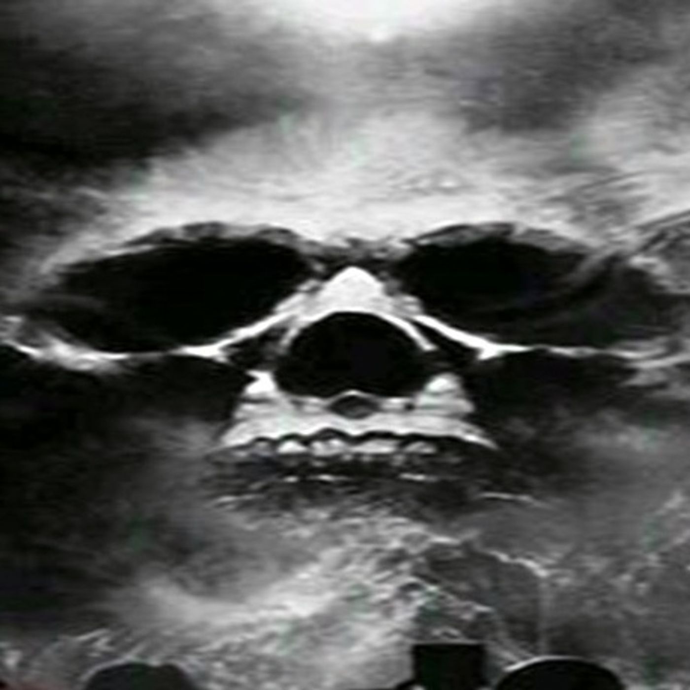 El Misterio De San Fernando Historias De Terror - REDE