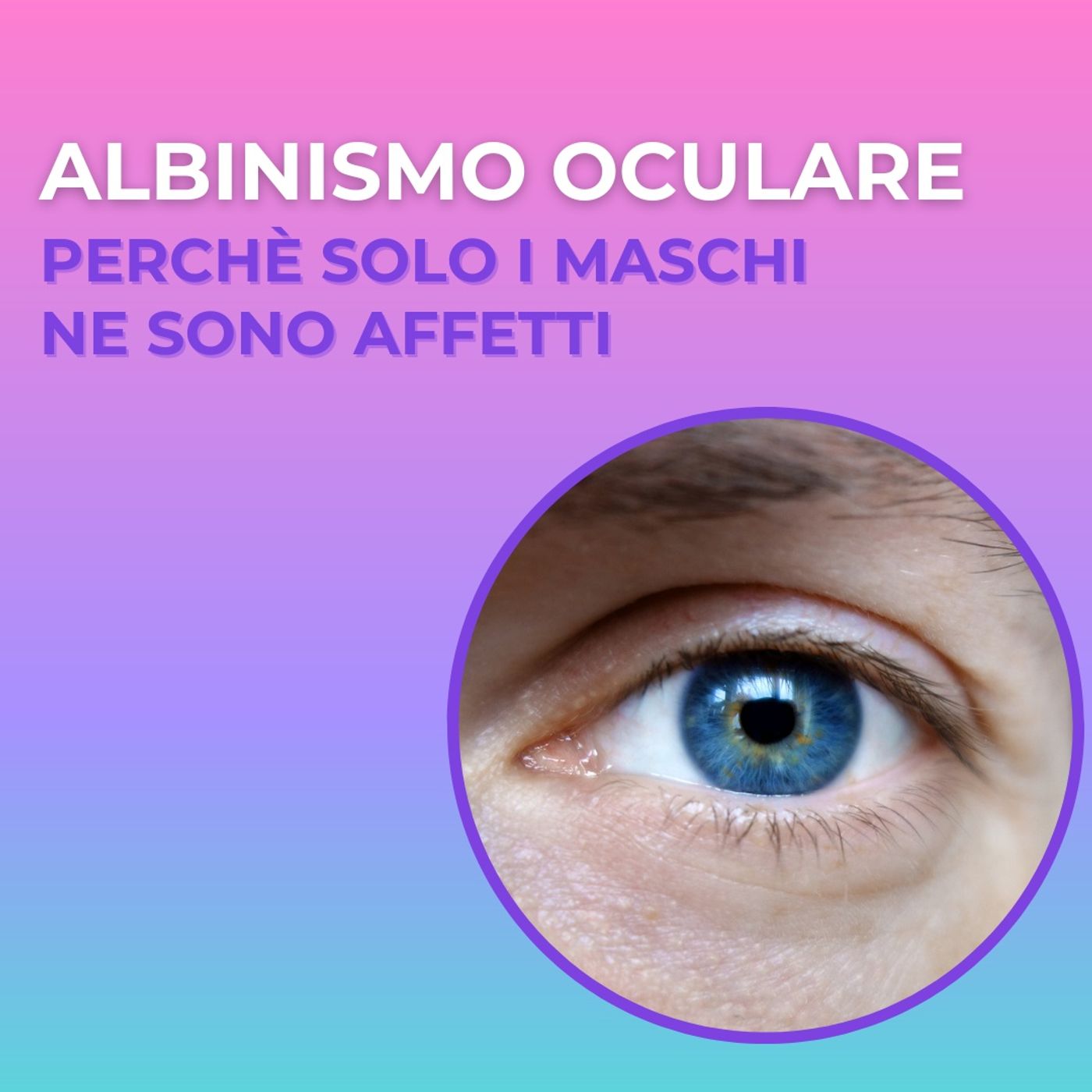 Nero su bianco  - storie di albinismo