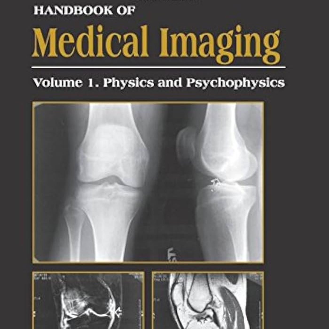Handbook of Medical Imaging, Volume 1. Physics and Psychophysics